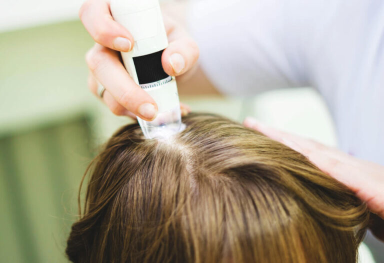 Trichoskopia – cyfrowa metoda badania włosów